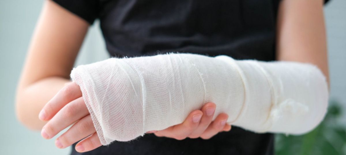 Перелом, гипс, рука, школа